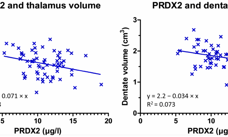 Oxidative stress affects multiple sclerosis