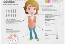 Conditions women hard diagnose