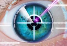 Bionic vision a telescope eye implant
