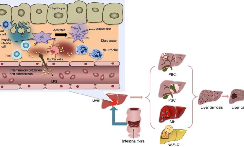 Gut bacteria liver damage