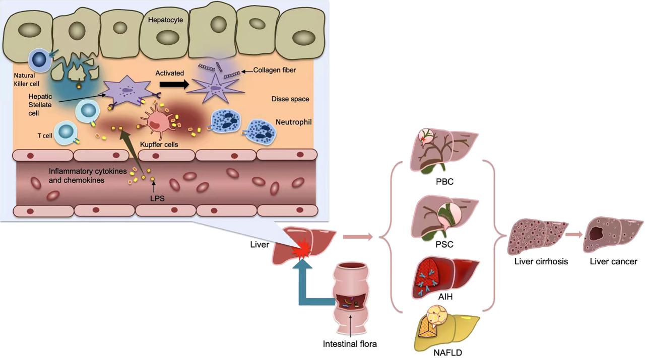 Gut bacteria liver damage