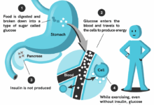 How eating only in the daytime can help people with type 2 diabetes