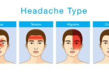 Increase reported in obesity related headaches how to avoid them