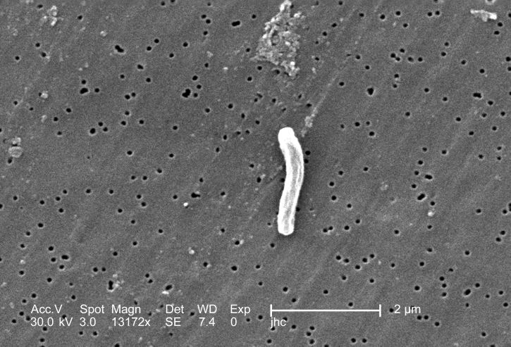 Why some diseases can be eradicated and others cant TEST