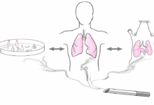 New documentary clears the air about copd