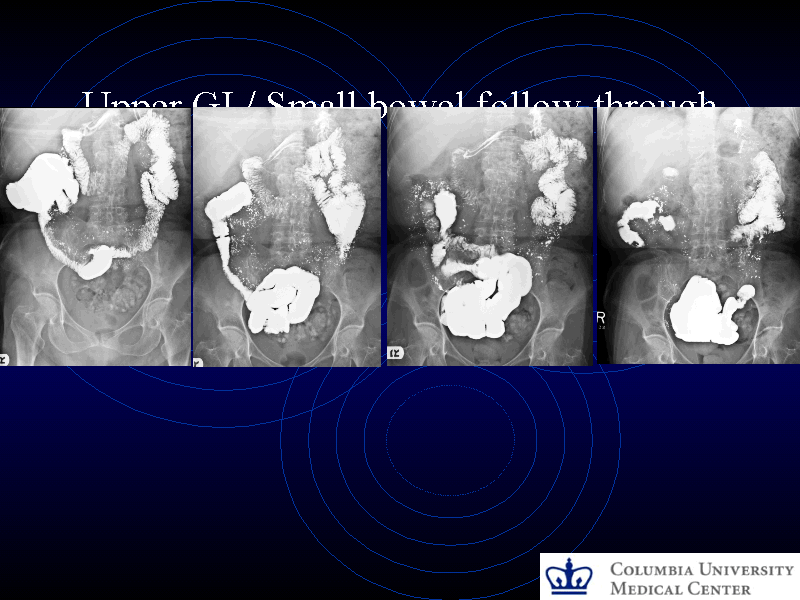 Upper gi and small bowel series
