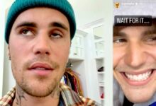 Justin bieber discloses he has ramsay hunt syndrome what to know