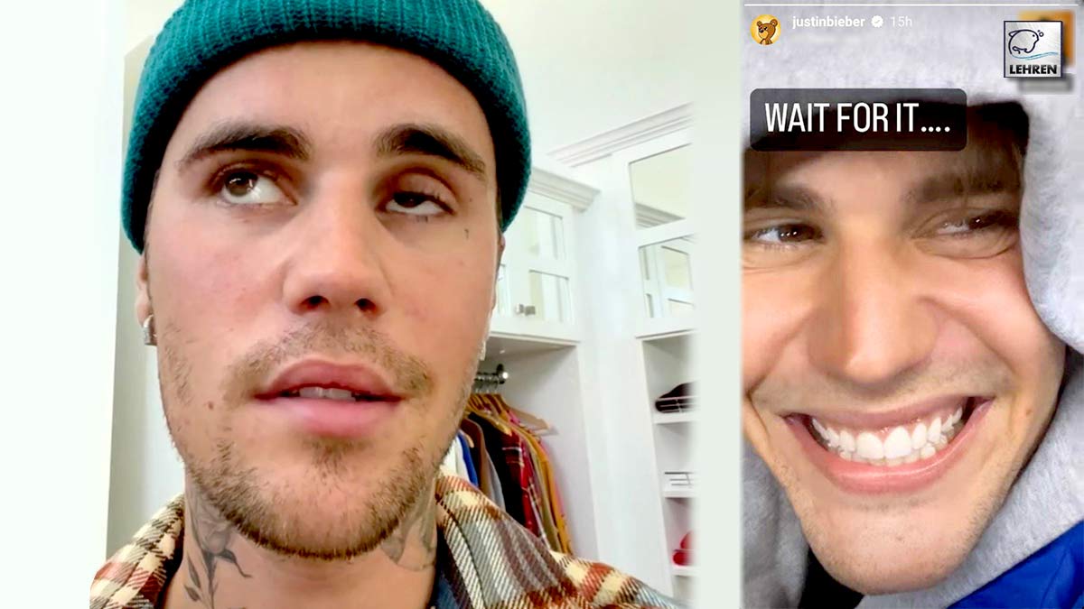 Justin bieber discloses he has ramsay hunt syndrome what to know