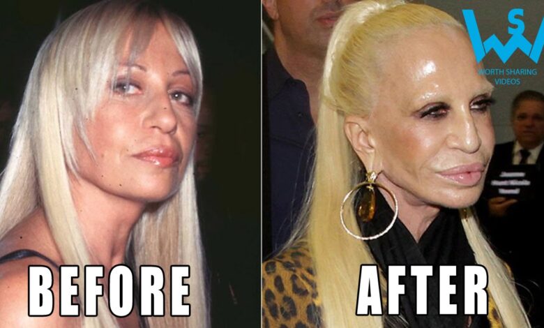 Dangerous plastic surgery procedures