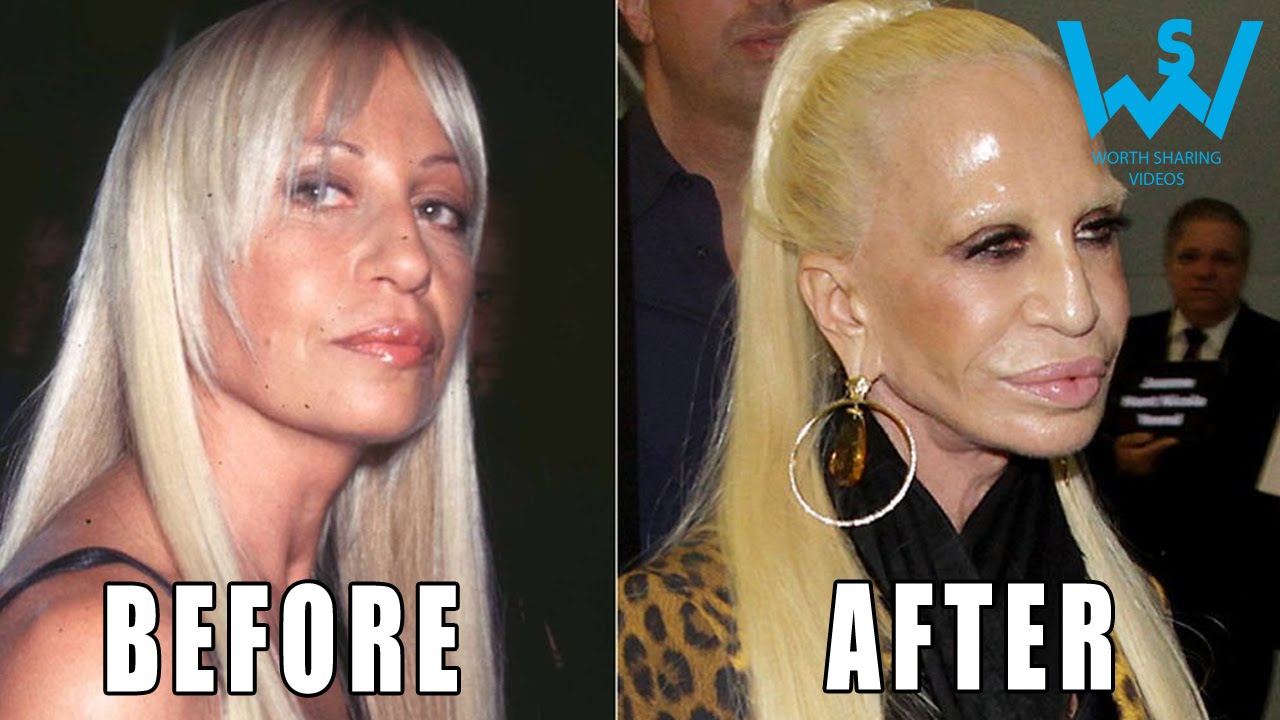 Dangerous plastic surgery procedures