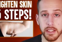 Loose rid skin get