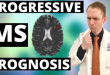 Predicting who will get progressive ms