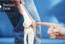 New technique can help people under 55 who are having knee surgery