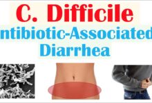 C diff symptoms treatment