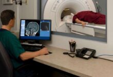 Diagnosing accurately sclerosis symptoms cedars sinai mri tricky resemble