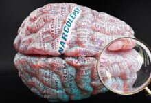 Narcolepsy and your brain