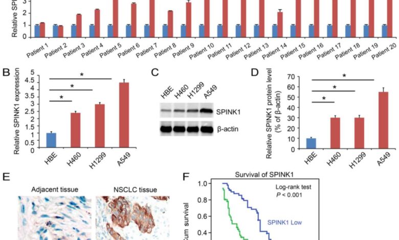 Prostate cancer gene spink1