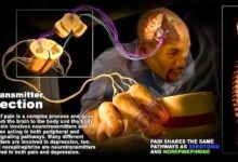 Pain relief central pain syndrome