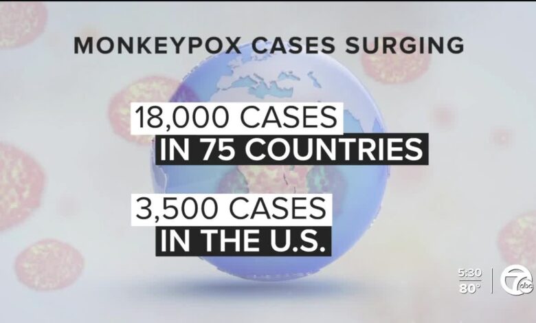 Second case of monkeypox reported in the us what to know