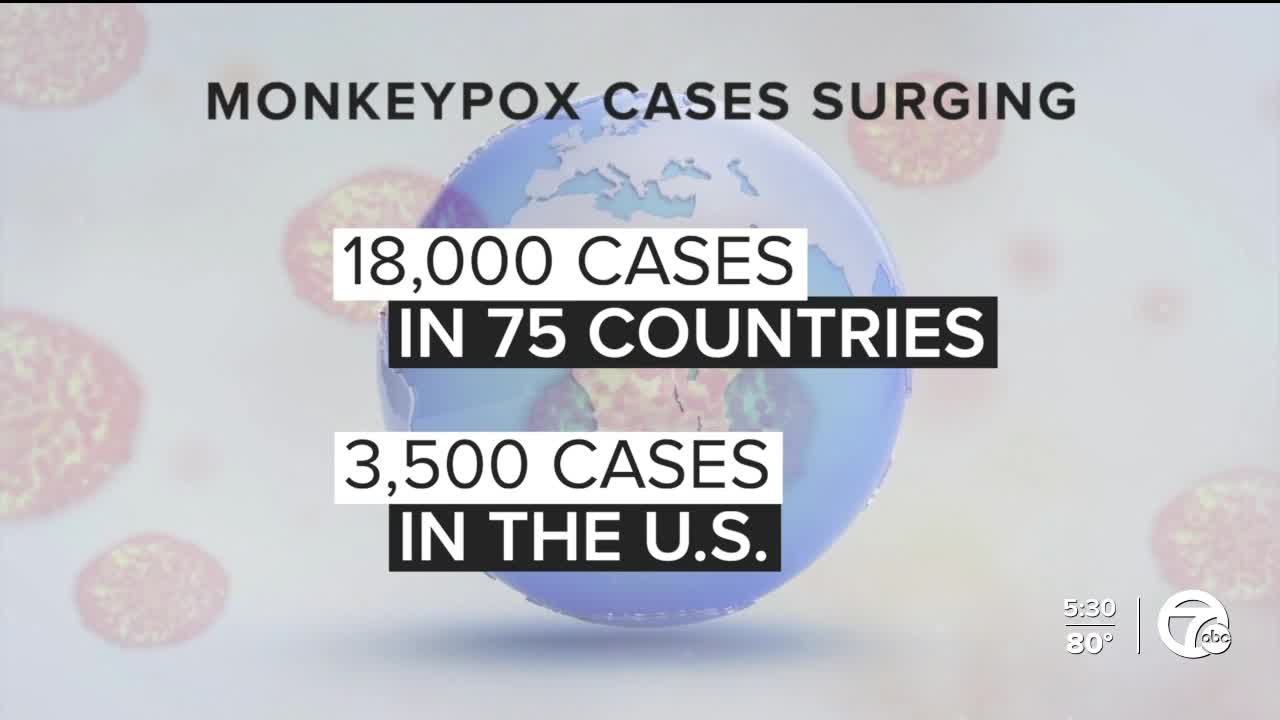 Second case of monkeypox reported in the us what to know