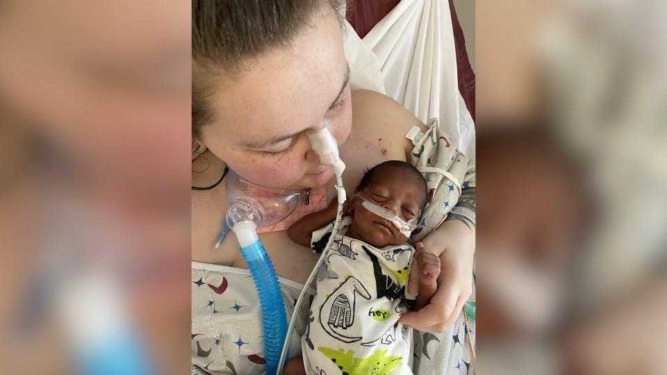 How doctors saved an infant with 3 weeks to live