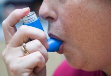 Obesity narrows airway leads to asthma