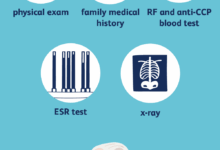 Common cancer screening used to detect rheumatoid arthritis
