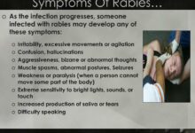 Can you treat rabies symptoms with rabies