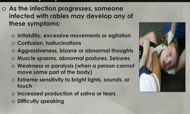 Can you treat rabies symptoms with rabies