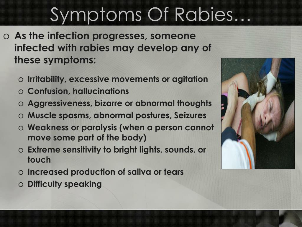 Can you treat rabies symptoms with rabies