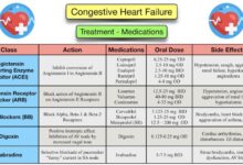 Drug shows promise treating heart failure