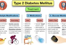 Ttp399 future type1 diabetes pill