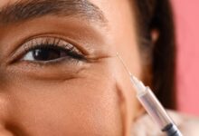Fda approves new under eye filler how it works