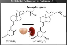 Vitamin d and prostate cancer