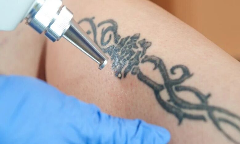 Tattoos