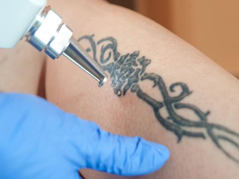 Tattoos