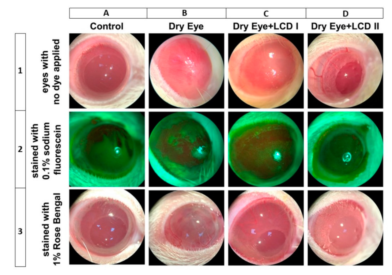 Caffeine and dry eye disease