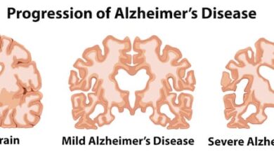 6 things people living with alzheimers want you to know