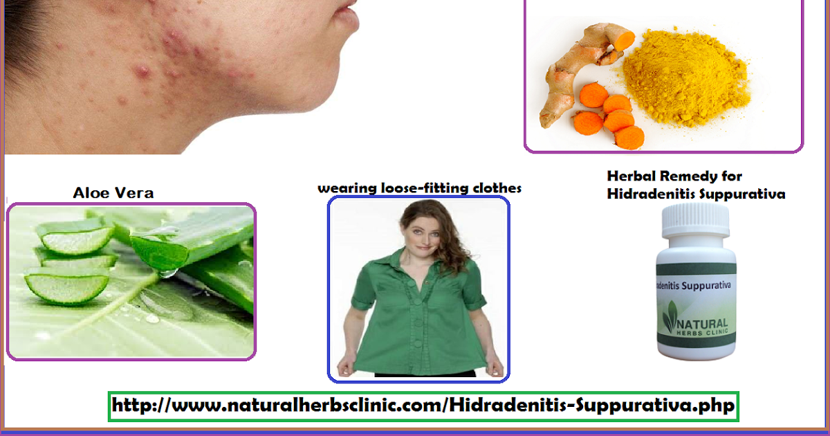 Best cleanser for hidradenitis suppurativa