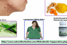 Best cleanser for hidradenitis suppurativa