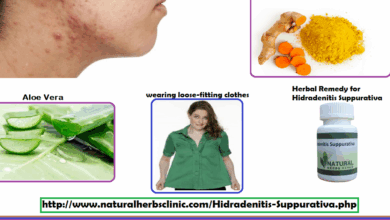 Best cleanser for hidradenitis suppurativa