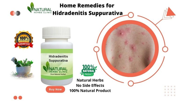 Best cleanser for hidradenitis suppurativa