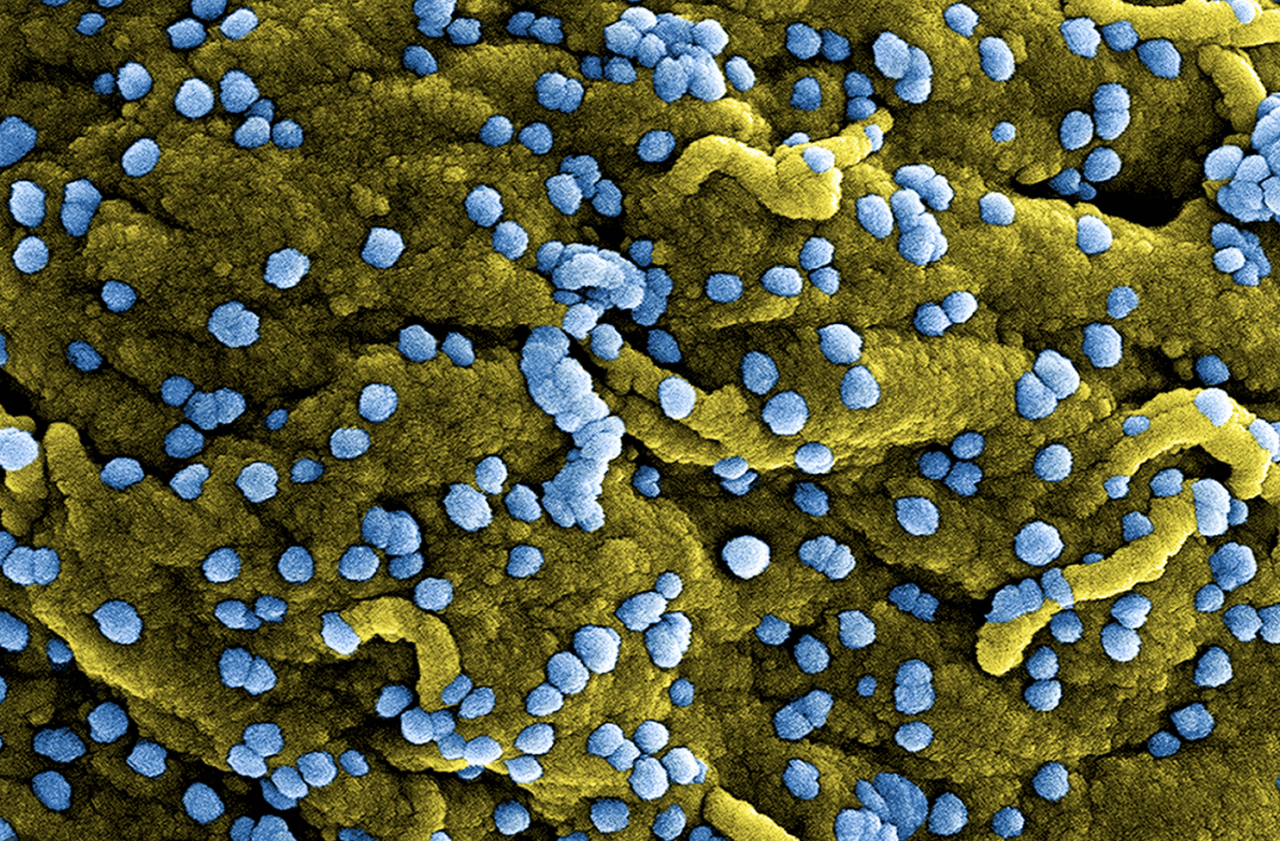 Could the marburg virus start another outbreak what we know