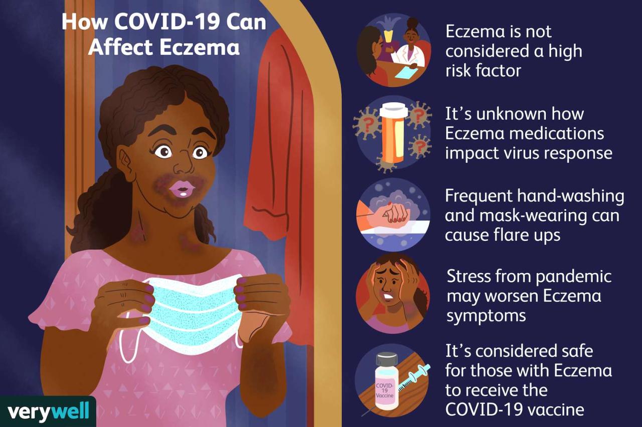Eczema after covid vaccine