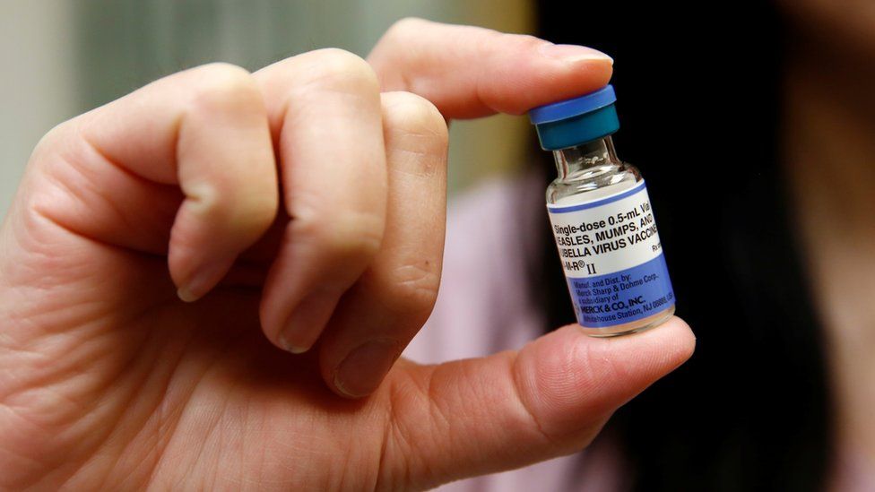 Why vaccinated people are getting mumps
