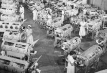 Mysterious polio like disease on the rise in the u s