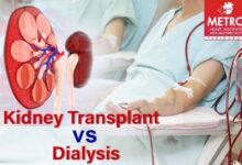 What to know about a potential overhaul for kidney transplants and dialysis