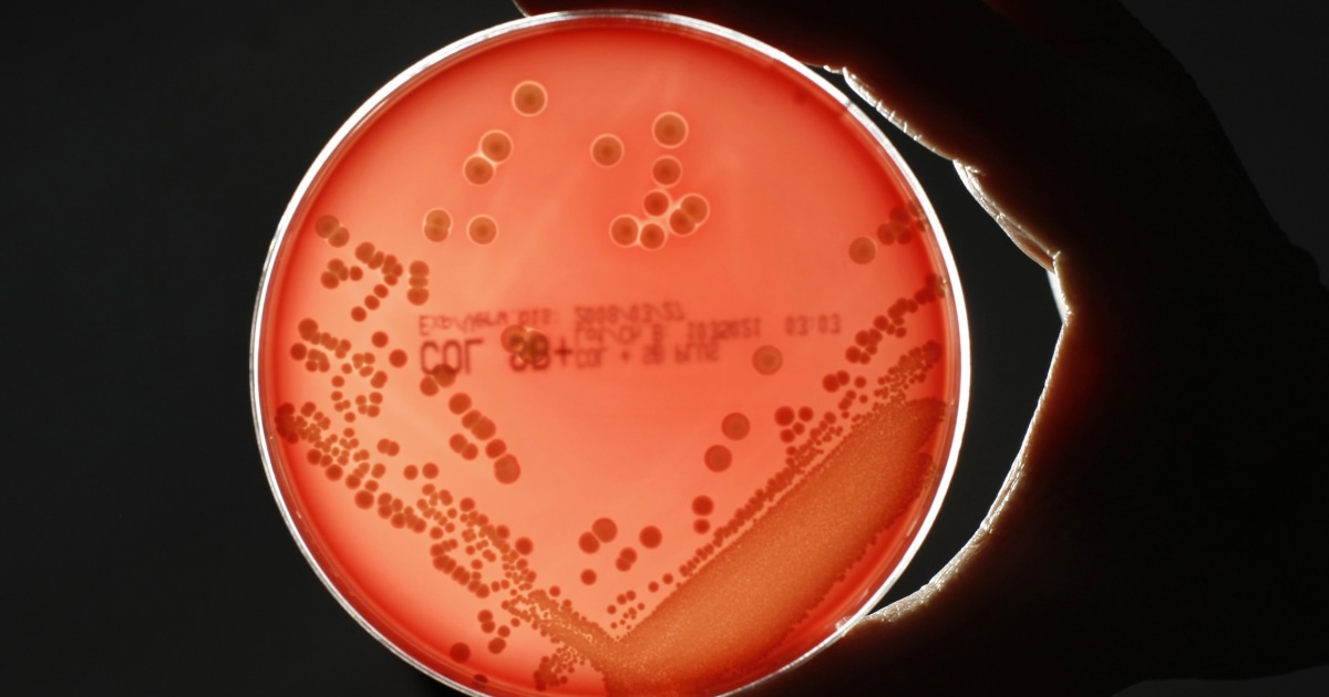 Drug resistant superbugs are causing more deaths whats being done