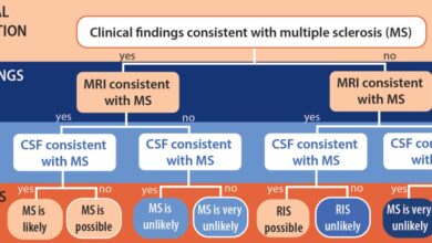 How to assess ms treatment