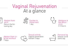 Why some women undergo vaginal rejuvenation